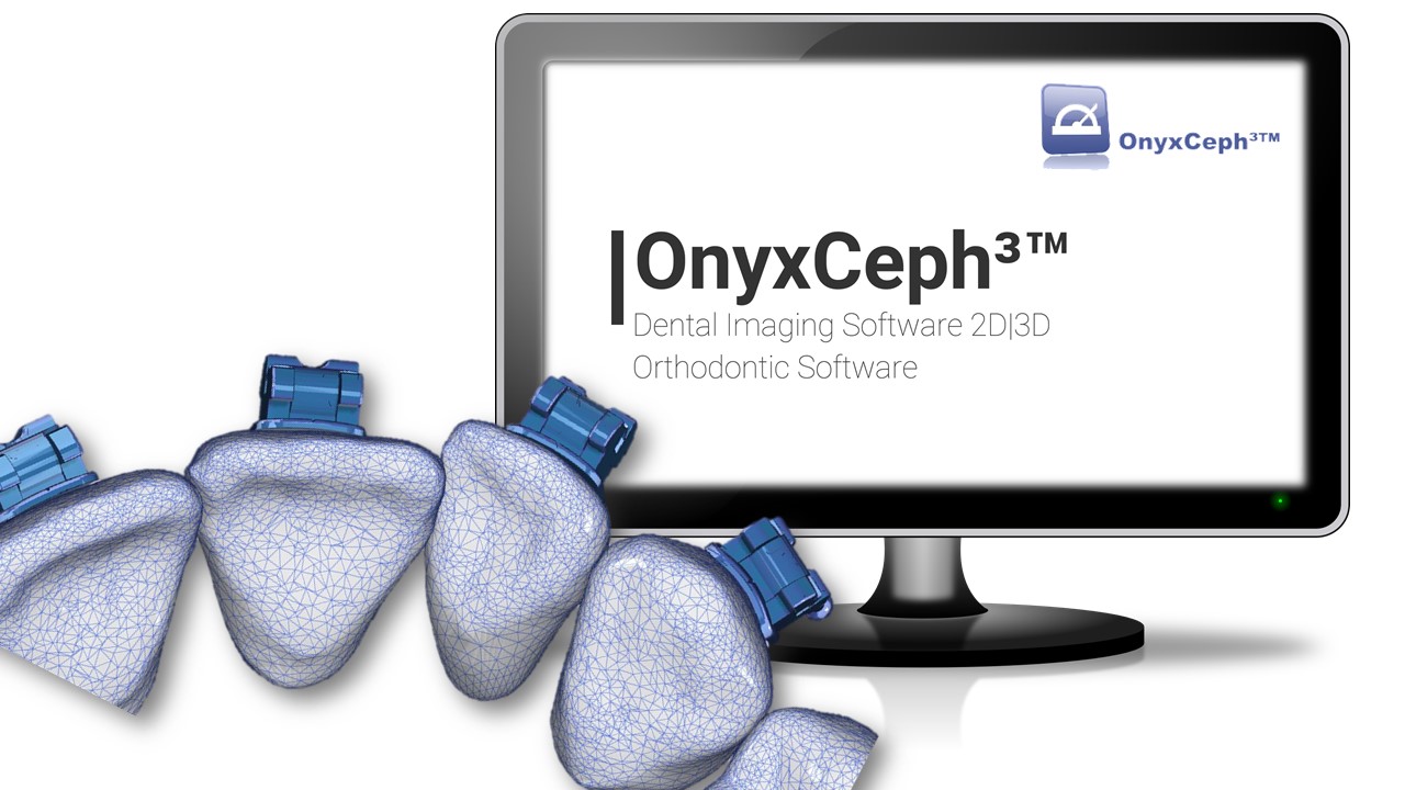 Die Möglichkeiten in OnyxCeph
