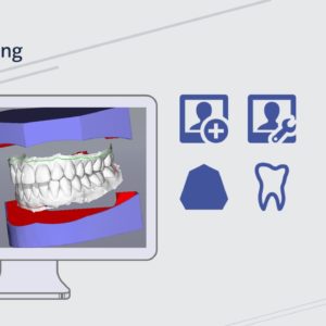 Ticket: Webinar - Aligner 1 2022/03/23 - 2022/03/23