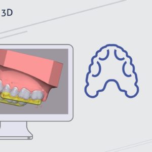 Ticket: Webinar - Bite Splint - Basics 2022/03/14 - 2022/03/14